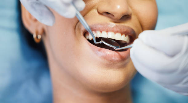 Best Emergency Dental Care for Sports Injuries in Eastlake, OH