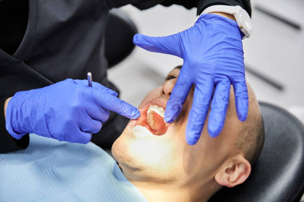 Best Knocked-Out Tooth (Avulsed Tooth) Treatment in Eastlake, OH